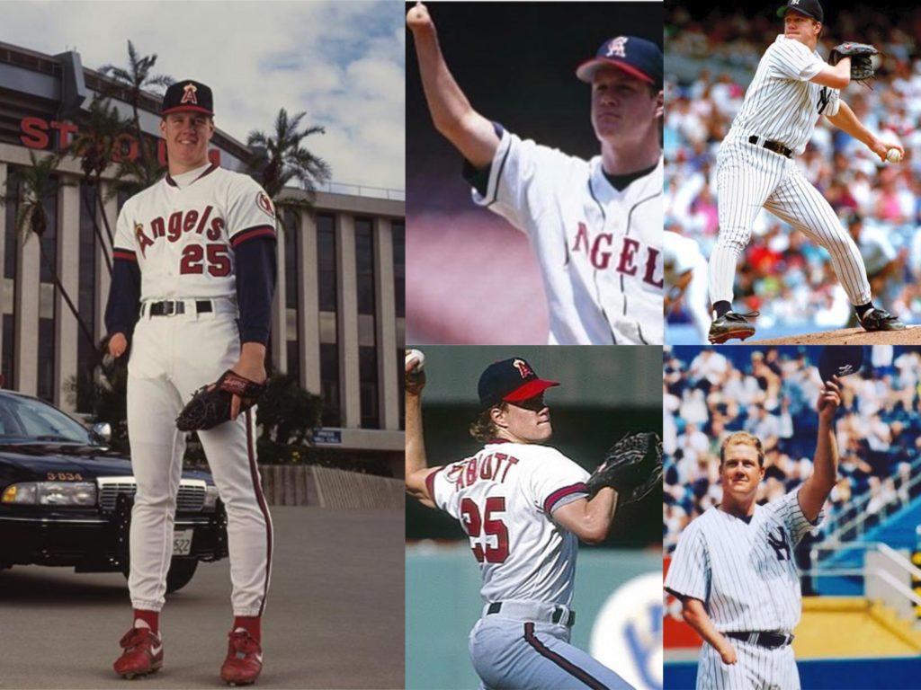 Jim Abbott was selected as one of the top athletes and sports stars born with Amniotic Band Syndrome.
